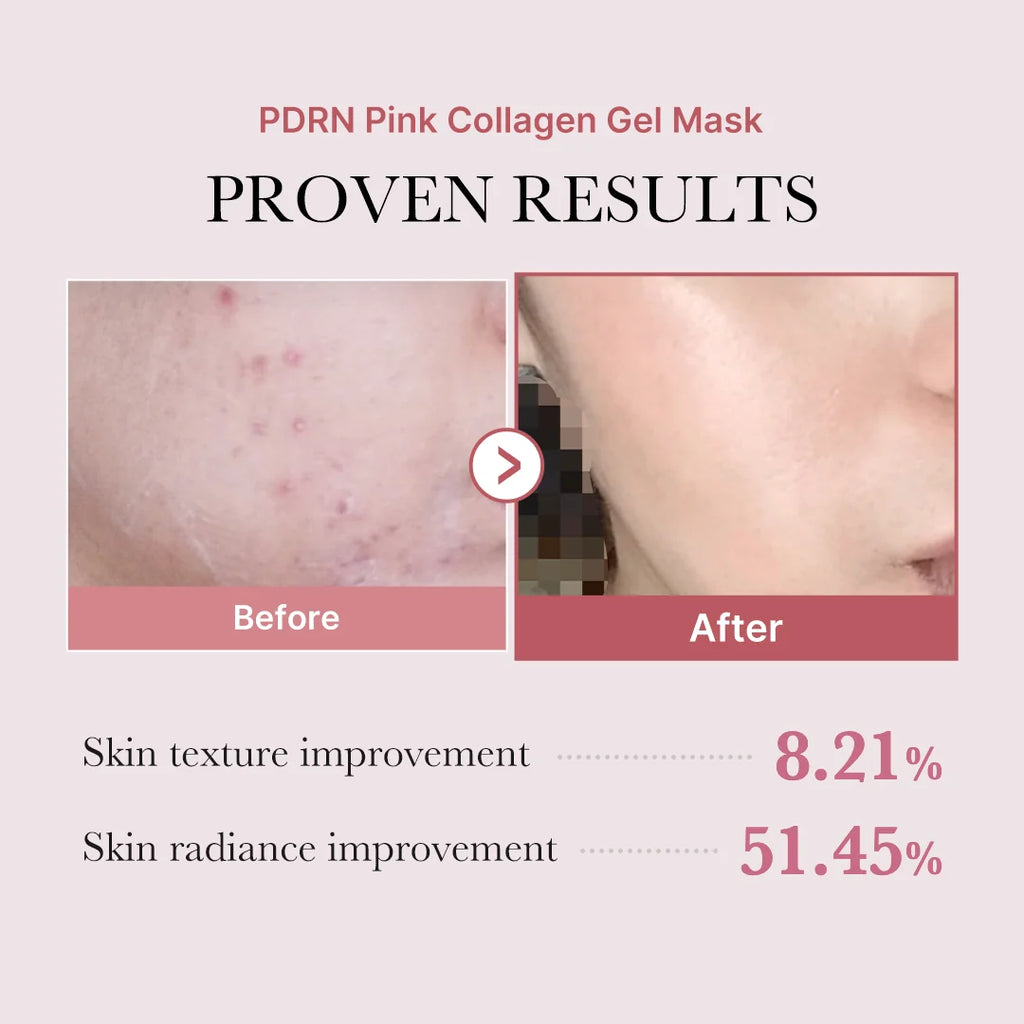 Medicube – PDRN Pink Collagen Gel Mask (uni)