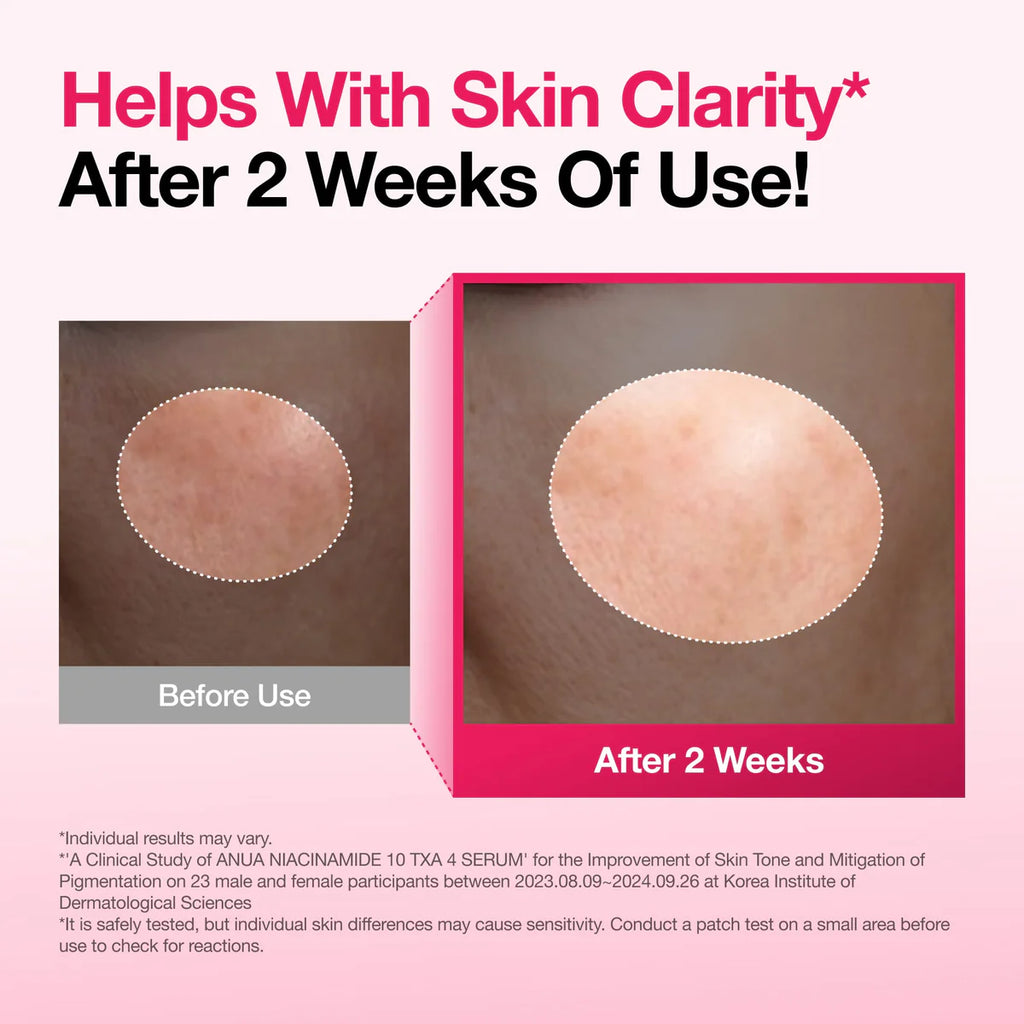 Anua - Niacinamide 10% + TXA 4% Serum