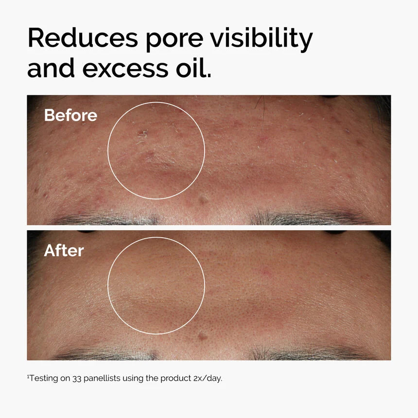 The Ordinary – Niacinamide 10% + Zinc 1% Serum 30ml