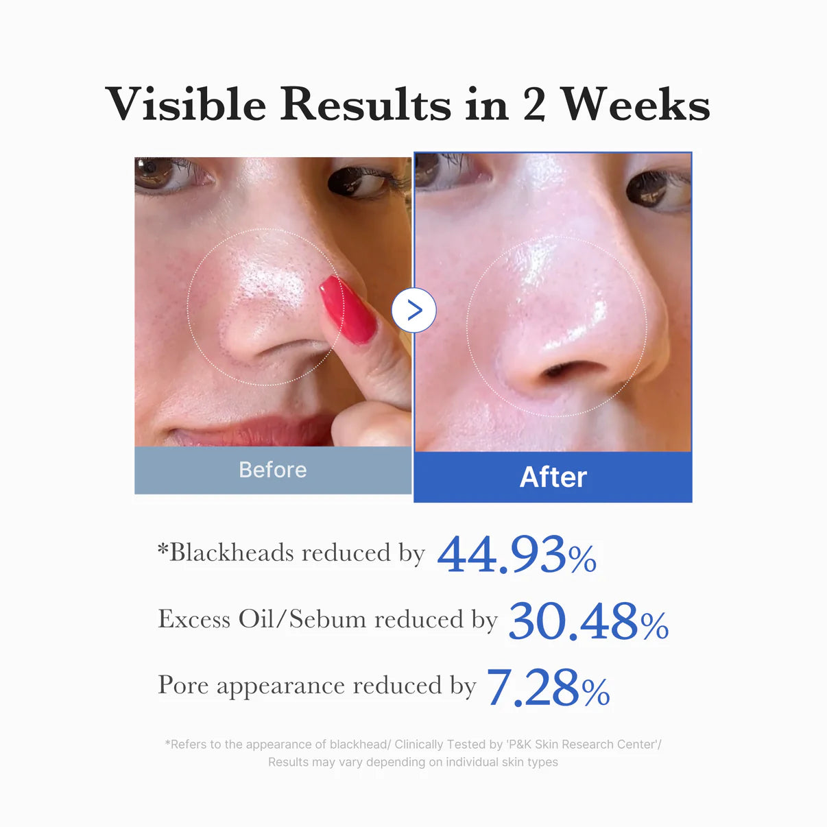 Medicube – Zero Pore Pad